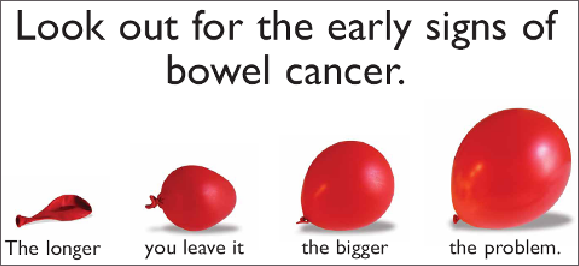 Bowel Cancer - Symptoms & Treatment